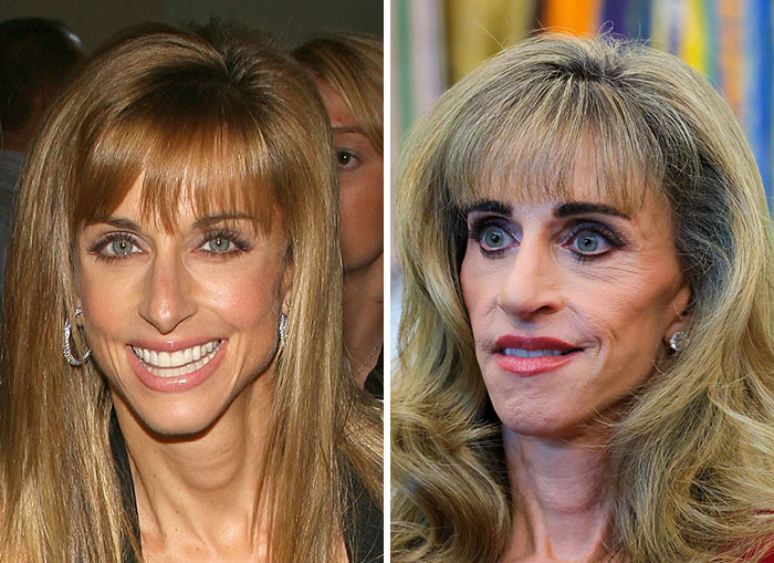 Side-by-side photos revealing extreme MAGA face makeover of woman linked to Trump