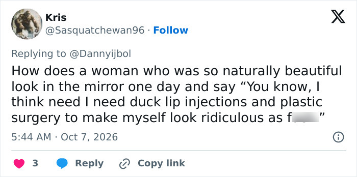 X post criticizing Megan Fox appearance and mentioning duck lip injections. X post criticizing Megan Fox appearance and mentioning duck lip injections.
