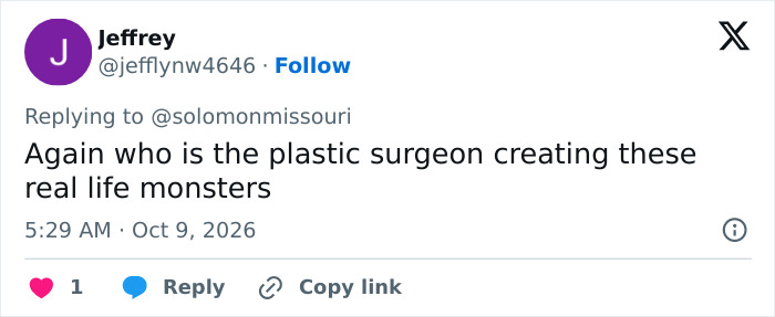 A social post criticizing plastic surgeon results, related to Susan Dell's Transformation.