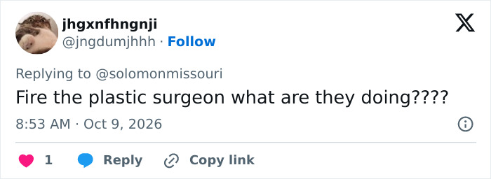 Social media user questioning plastic surgery outcomes in relation to Susan Dell's transformation debate.