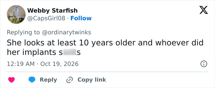 Tweet saying Taylor Swift looks 10 years older after implants in Mar-A-Lago face debate Tweet saying Taylor Swift looks 10 years older after implants in Mar-A-Lago face debate