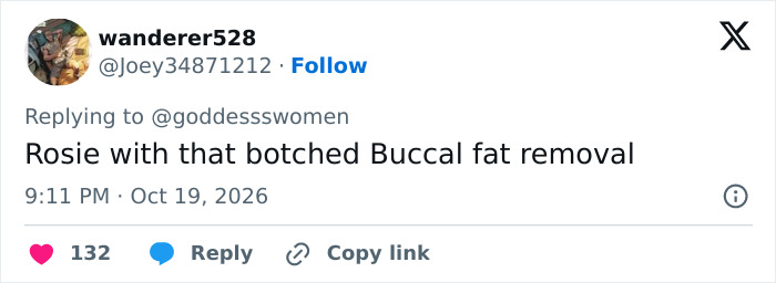 A social media post commenting on a botched cosmetic procedure during the popular plastic surgery trend. A social media post commenting on a botched cosmetic procedure during the popular plastic surgery trend.