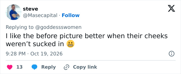 A social media user sharing opinions on plastic surgery trend cosmetic changes. A social media user sharing opinions on plastic surgery trend cosmetic changes.
