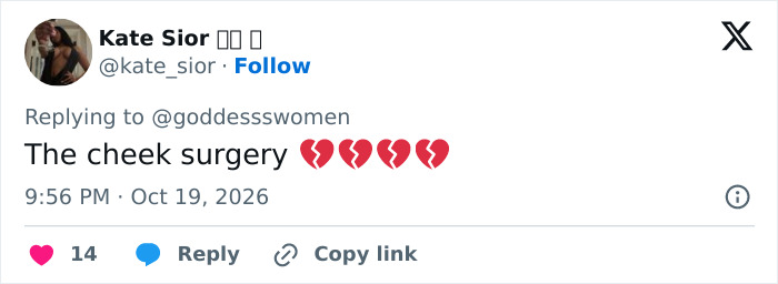A social media post about cheek surgery, relating to plastic surgery trends among Victoria's Secret models. A social media post about cheek surgery, relating to plastic surgery trends among Victoria's Secret models.