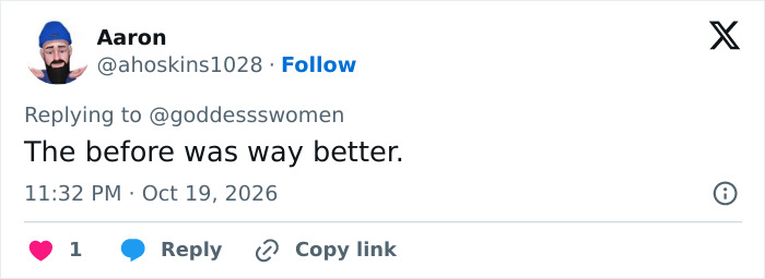 User post commenting on plastic surgery trend, stating the before look was way better. User post commenting on plastic surgery trend, stating the before look was way better.