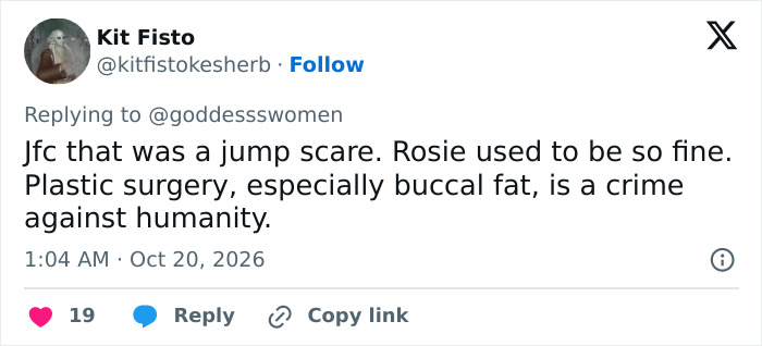 A social media post discussing the plastic surgery trend and buccal fat removal. A social media post discussing the plastic surgery trend and buccal fat removal.