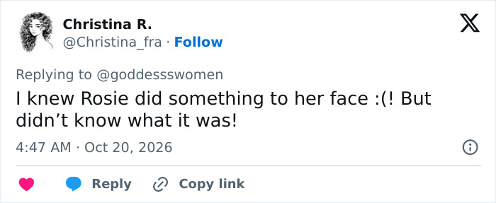 User post suspecting cosmetic procedures in the context of the plastic surgery trend. User post suspecting cosmetic procedures in the context of the plastic surgery trend.