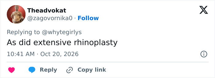 A social media reply discussing rhinoplasty and plastic surgery trends in Victoria's Secret models. A social media reply discussing rhinoplasty and plastic surgery trends in Victoria's Secret models.