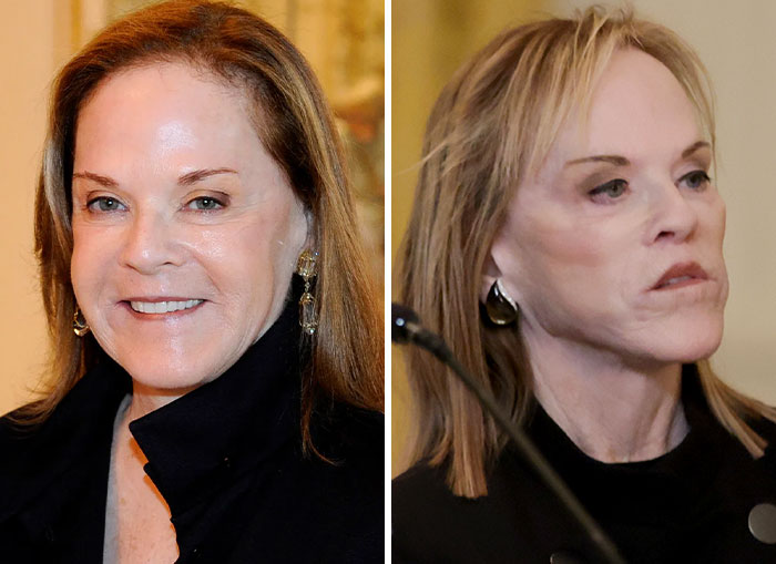 Before and after pictures of woman in Trump's circle with extreme MAGA face changes
