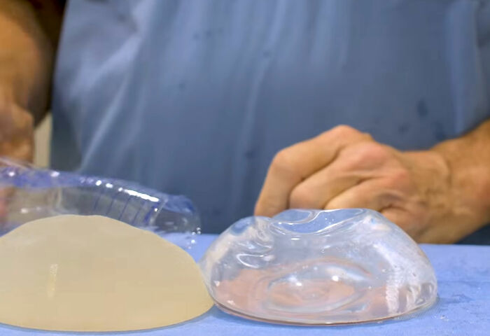 Close-up of silicone implants being inspected in a medical setting, relevant to Christina Applegate health updates.