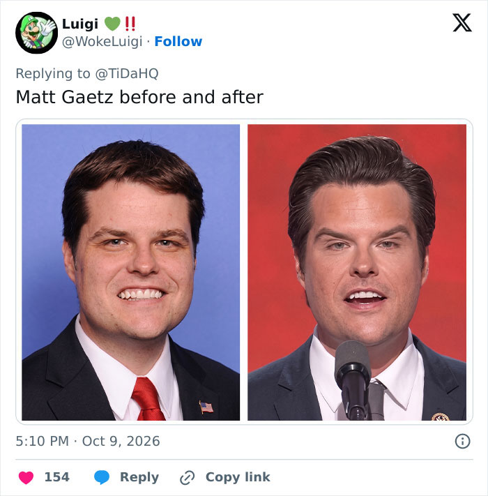 Side by side comparison of Matt Gaetz showing facial transformation related to MAGA face trends. Side by side comparison of Matt Gaetz showing facial transformation related to MAGA face trends.