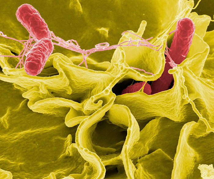 Microscopic image of red bacteria related to life-threatening illness risks
