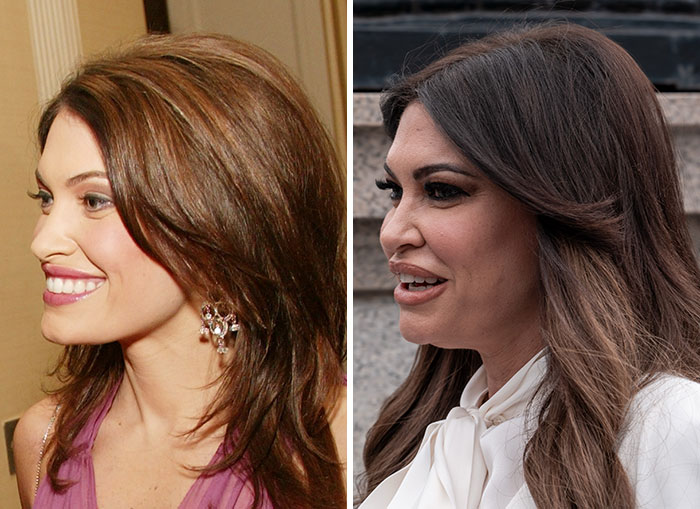 Before and after images of Trump's circle women displaying MAGA face changes