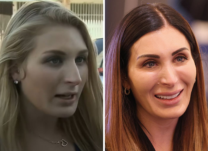 Transformation photos of women in Trump's circle with noticeable MAGA face
