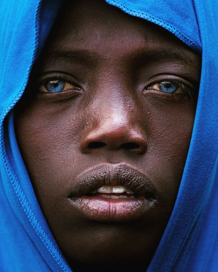 Close-up portrait photo of a person with vivid blue eyes wearing a blue hood, depicting a powerful human expression.