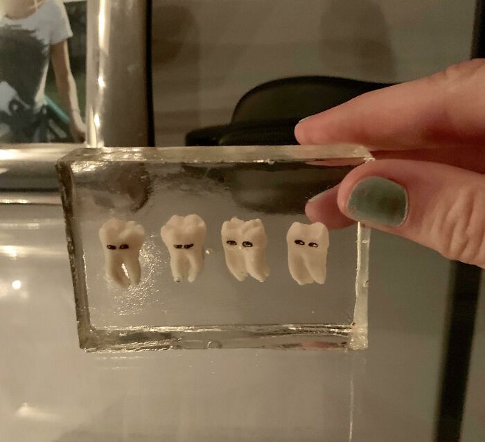 Four wisdom teeth preserved inside a clear resin block, a quirky DIY project idea.