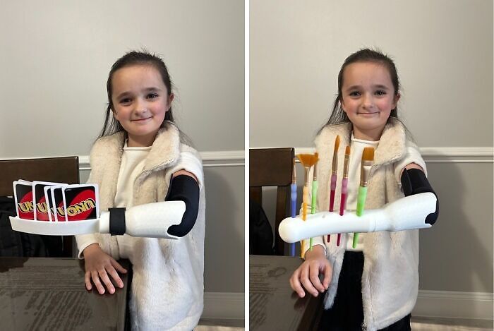 A young girl with a prosthetic arm holding Uno cards and paintbrushes, showcasing cool and entertaining pics
