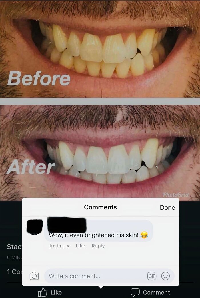 Before and after teeth whitening photo with a funny comment, showing how companies tried way too hard to sell.