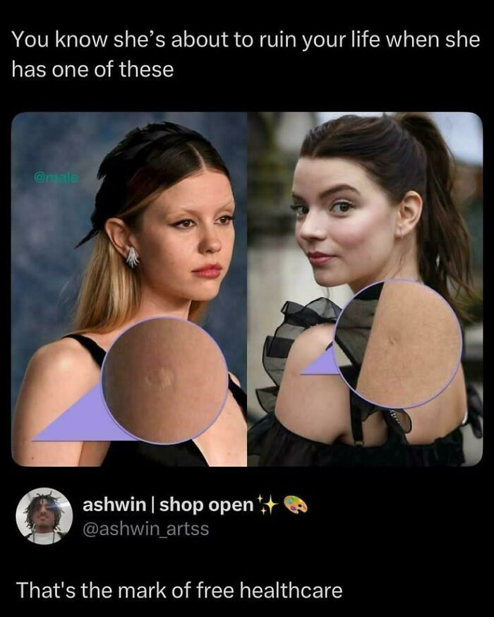 Meme about marks from free healthcare on shoulders of two women