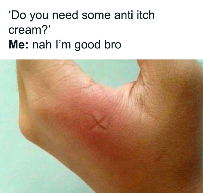 Hand with red itchy skin and anti itch cream joke meme