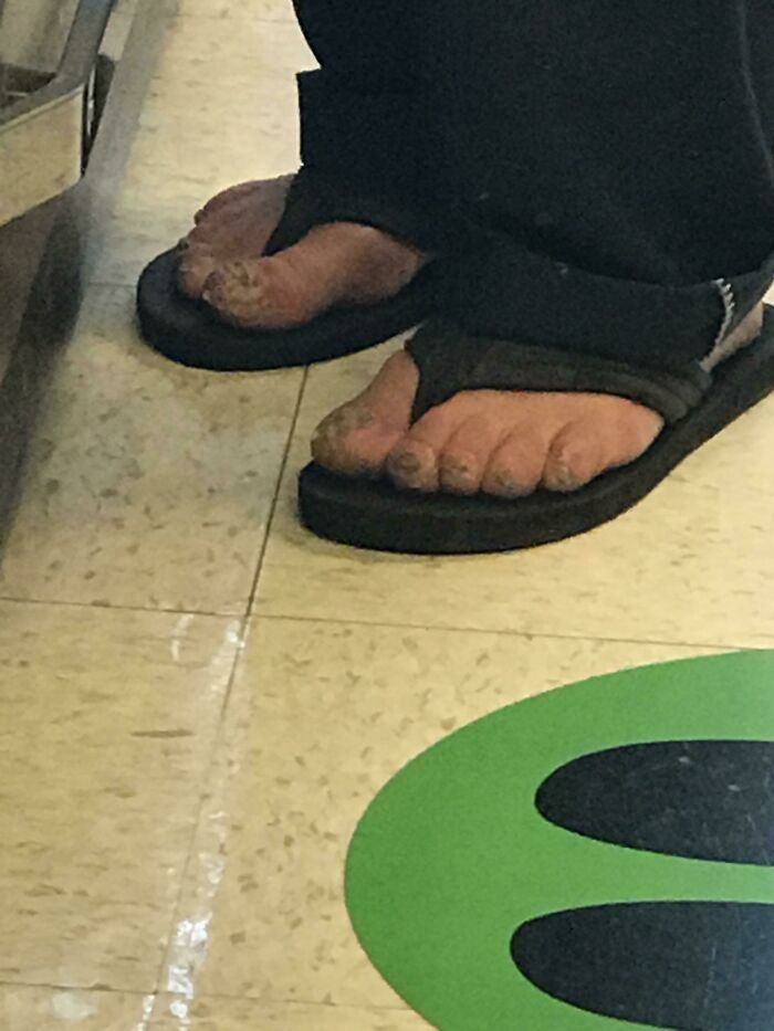 Close-up of worn feet in flip-flops standing on Walmart floor