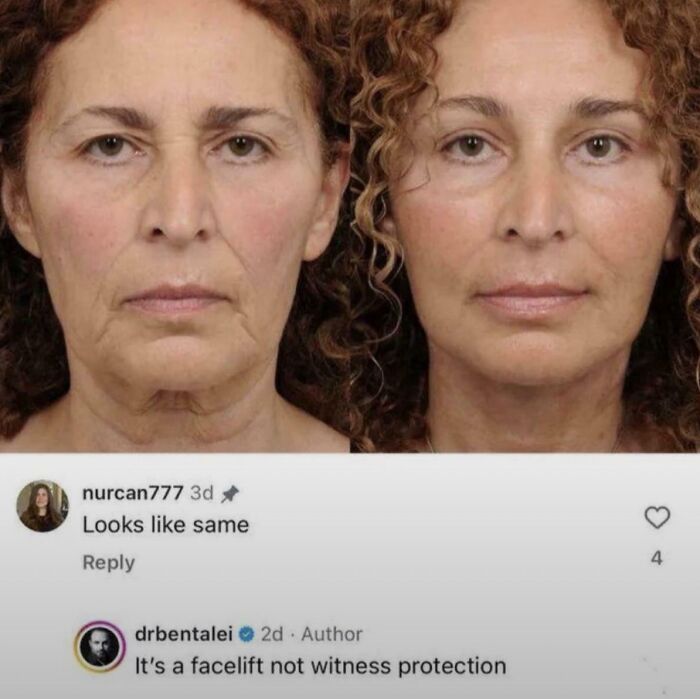 It’s A Facelift, Not Witness Protection