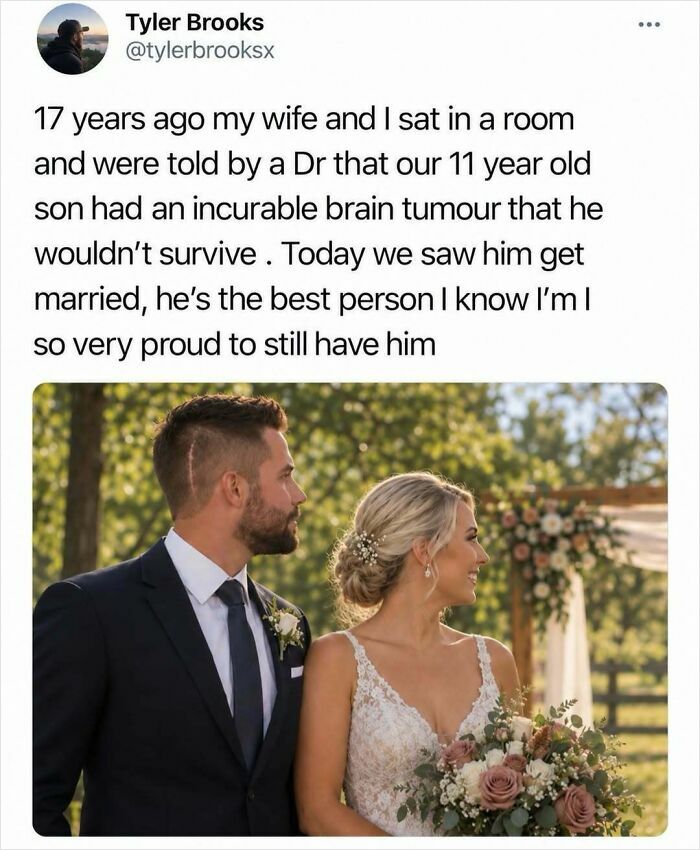 An entertaining post featuring a groom with a visible surgery scar standing next to his bride.