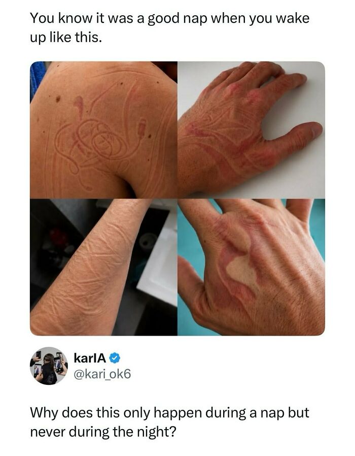 Collage of red skin marks after nap for random photos that are weird and funny