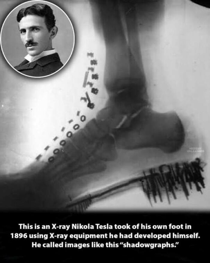 Nikola Tesla foot X-ray shadowgraph showing unique history moments and scientific past innovation.