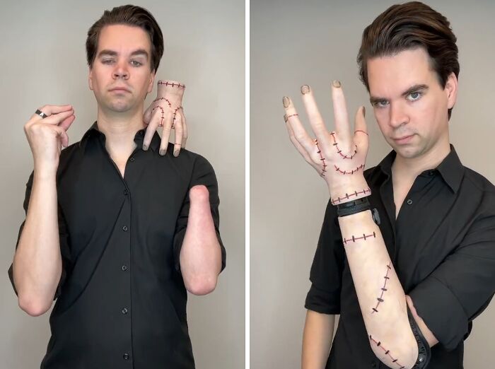 A man showing a custom hand prosthetic, representing creative people with disabilities winning Halloween.