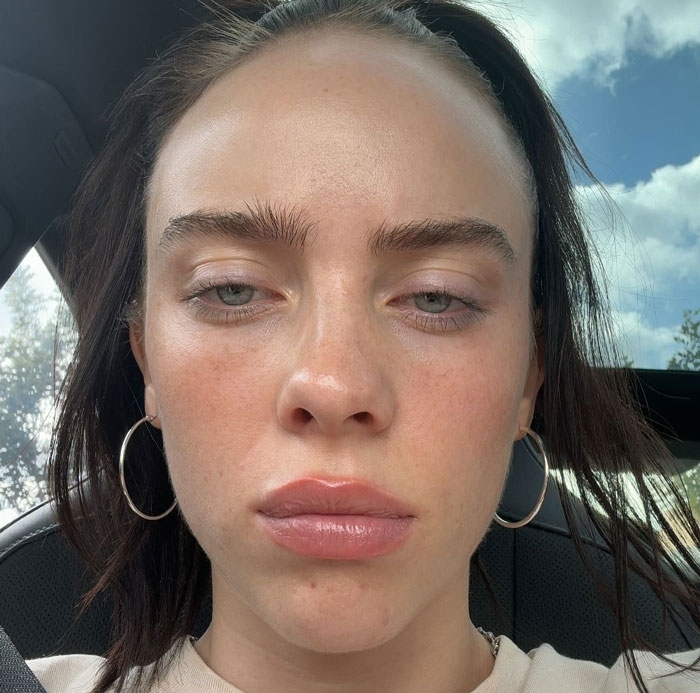 Billie Eilish Has Fans Guessing After Her Latest Photos Trigger Plastic Surgery Speculation Billie Eilish Has Fans Guessing After Her Latest Photos Trigger Plastic Surgery Speculation