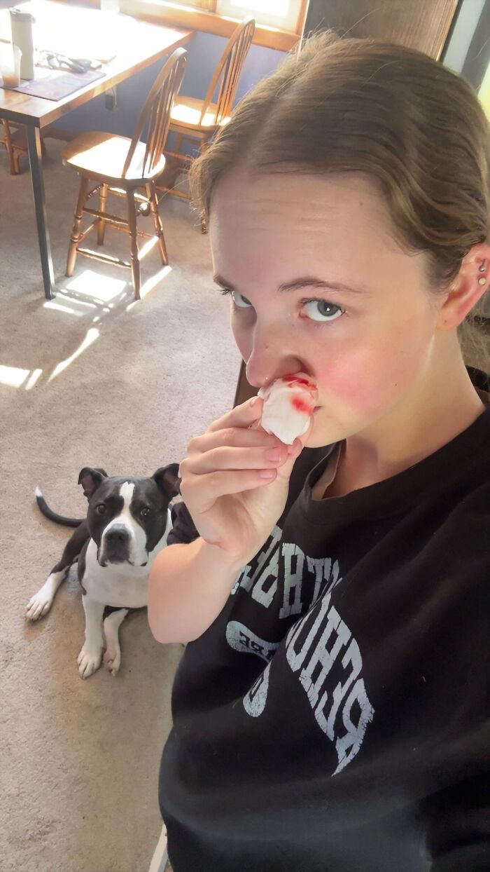 A young woman holding a bloody tissue to her nose beside her black and white dog sharing life stories