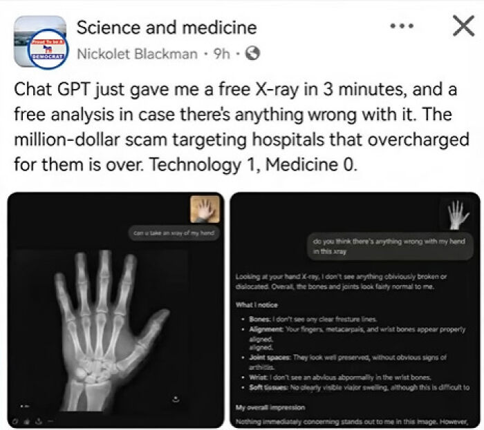 A post with a hand X-ray generated by ChatGPT, representing one of the absurd moments on social media.
