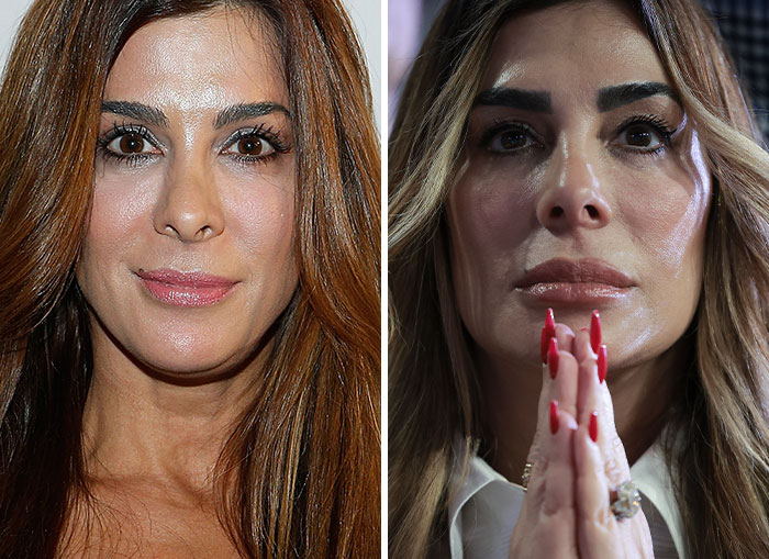 Before and after photos showing extreme MAGA face transformation of woman in Trump's circle