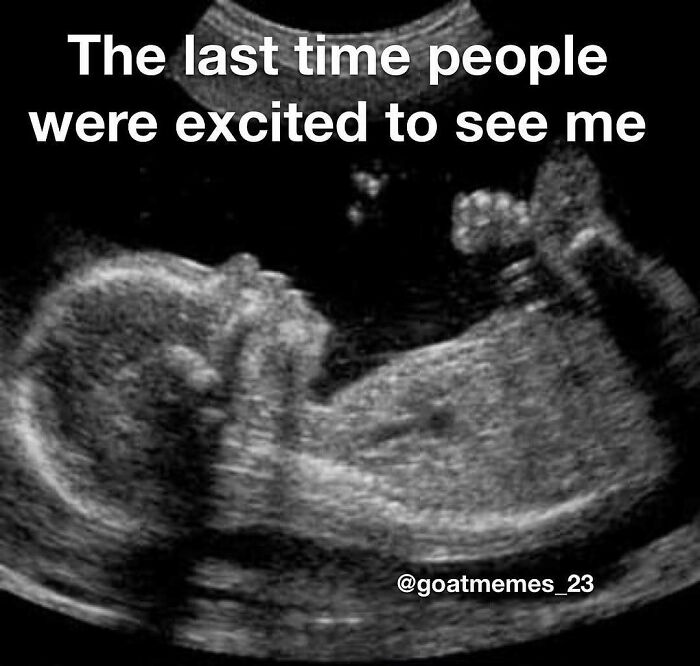 Baby ultrasound scan meme about excitement, perfect for sending memes to friends.