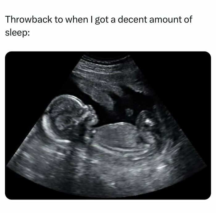 Ultrasound image representing a throwback to a decent amount of sleep meme