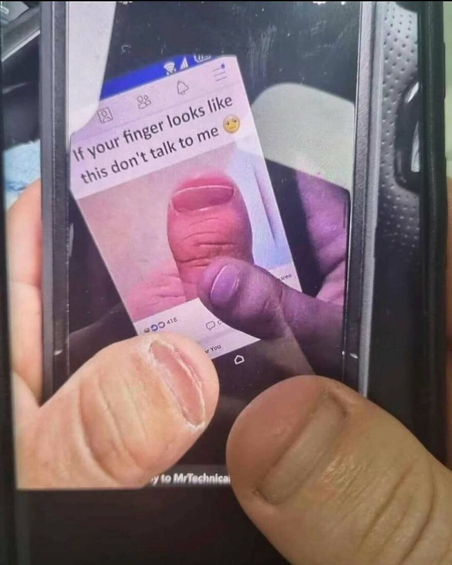 Out-of-context pics of a thumb matching a funny social media post showing a similar looking finger on a phone screen.