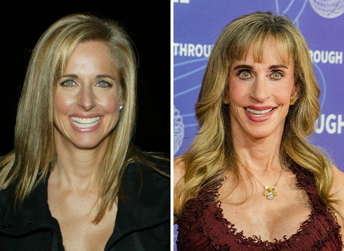 Before and after comparison photo of the billionaire spotted at a public gathering Before and after comparison photo of the billionaire spotted at a public gathering