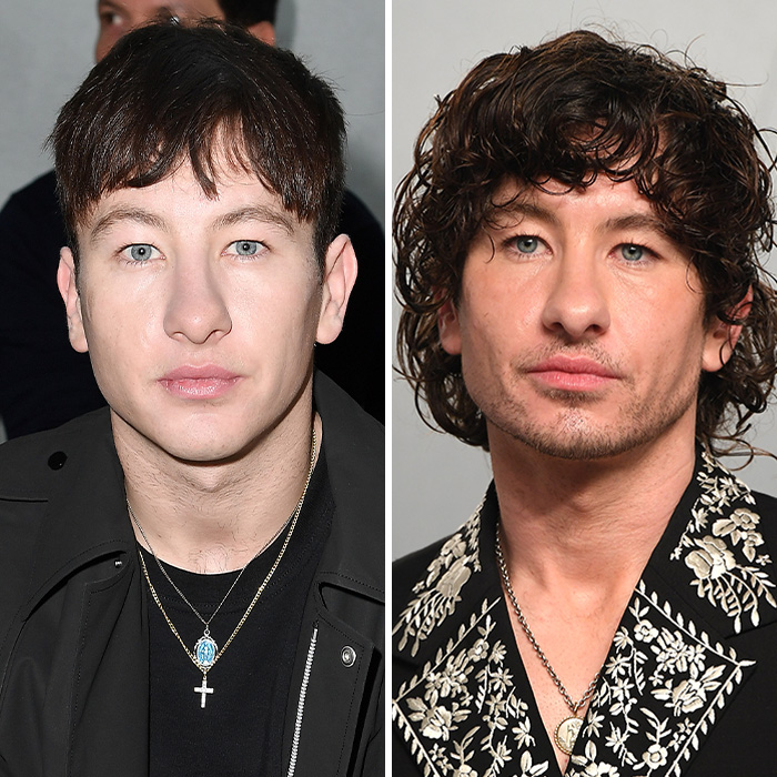Side by side photos showing Barry Keoghan before and after his cosmetic procedure.