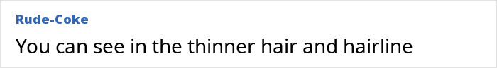A comment regarding hair changes after Billie Eilish reveals slimmed down figure A comment regarding hair changes after Billie Eilish reveals slimmed down figure