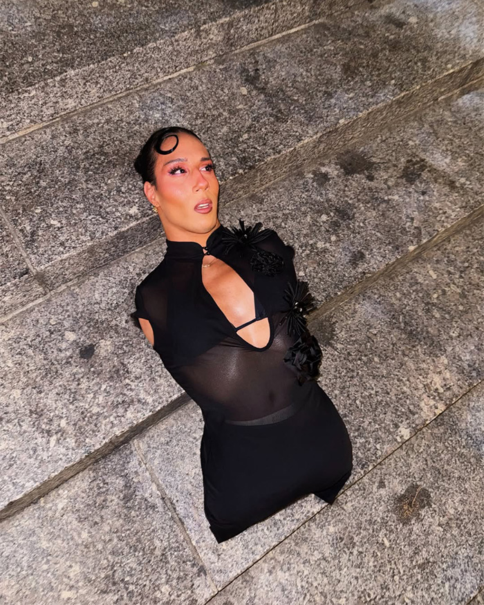 Trans influencer born without limbs posing on stone stairs in a stylish black dress. Trans influencer born without limbs posing on stone stairs in a stylish black dress.