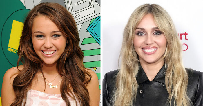 After Jennifer Lawrence’s Viral Plastic Surgery Transformation And Confession, Here Are 8 Other Stars Who Might Have Gotten Blepharoplasty