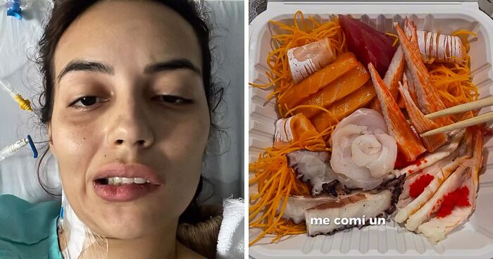 Young Influencer Left With Facial Paralysis After 23-Day Period In ICU Over Eating Sushi, Doctors Explain The Risks