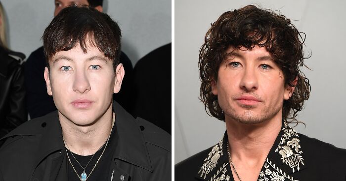 Barry Keoghan Undergoes $6,000 Cosmetic Procedure For Upcoming Role As Backlash Over His Appearance Mounts