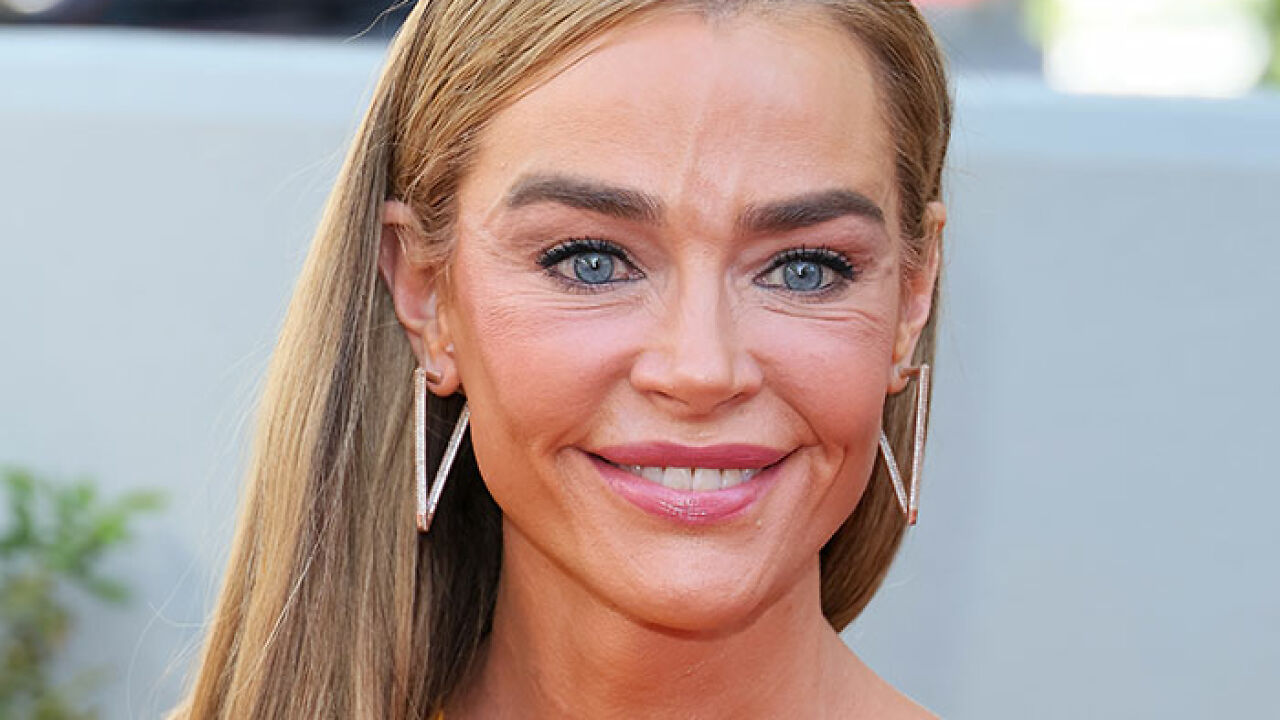 Denise Richards’ $200K Facelift Fuels ‘The Substance’ Comparisons As Before-And-After Photos Go Viral