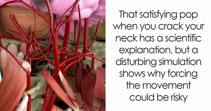 Doc Shares Graphic Simulation Of Neck Cracking, Revealing How A Simple Twist Could Lead To A Stroke