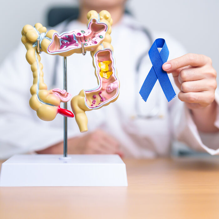 Doctor holding a blue ribbon next to a colon model, highlighting health problems in Gen Z.