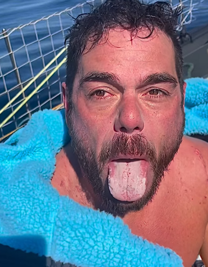 Extreme swimmer sticks out his tongue showing severe irritation and white coating after a long open water swim Extreme swimmer sticks out his tongue showing severe irritation and white coating after a long open water swim