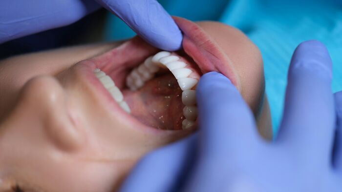 A dentist in gloved hands examining a patient's open mouth and teeth, illustrating dumb things professionals said or did.