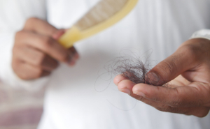 15% Of Americans Have Taken A GLP-1, And Dermatologists Now Have A Timeline For When The Hair Goes